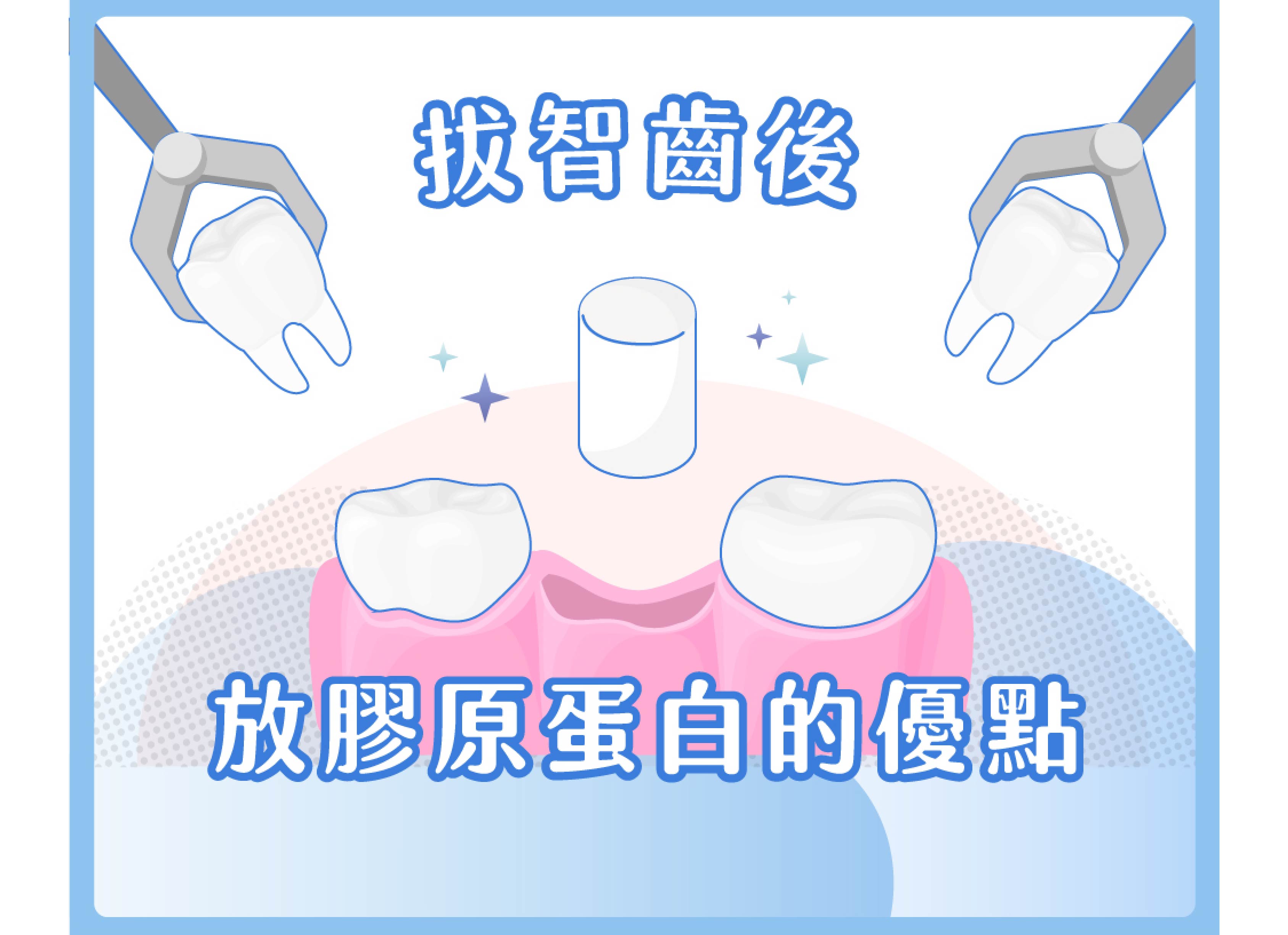 拔牙、拔智齒時醫師會建議放入傷口的膠原蛋白是什麼？