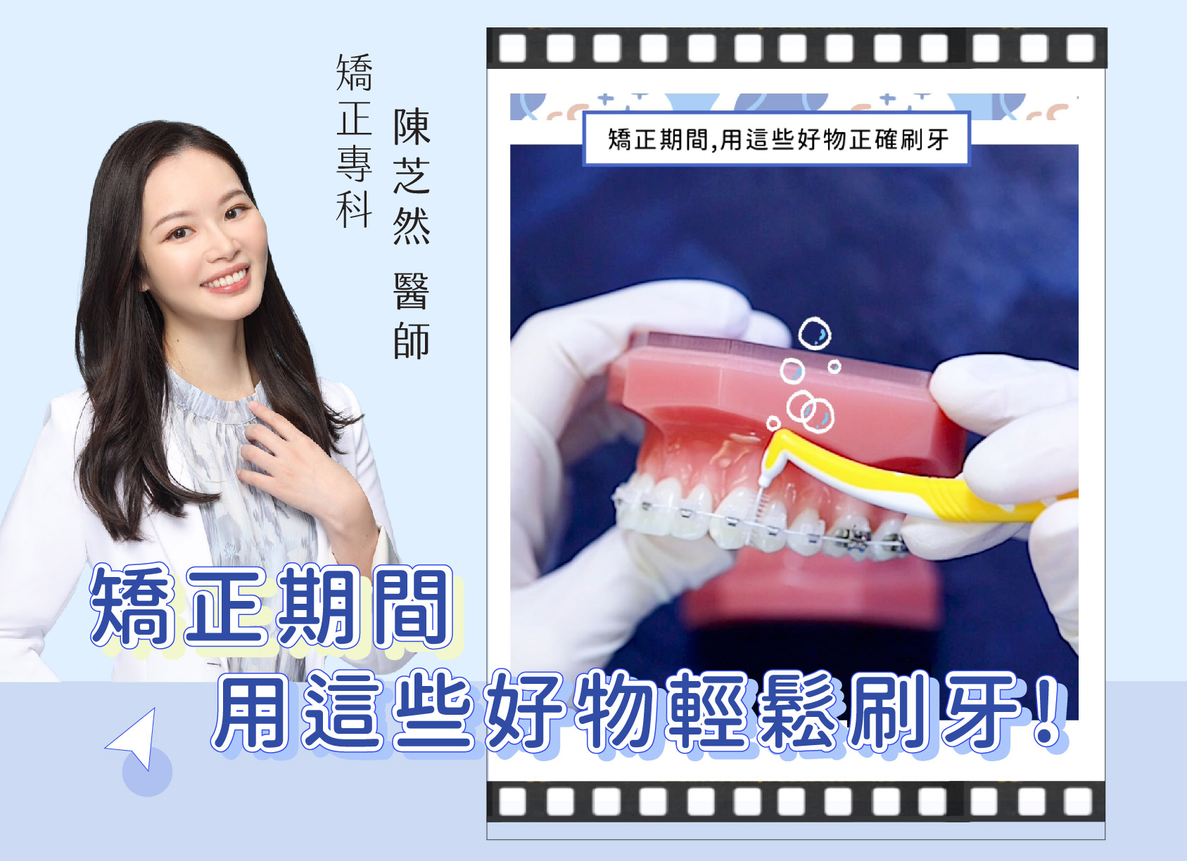 陳芝然醫師介紹 矯正期間要用哪些東西來清潔？怎麼用才正確？