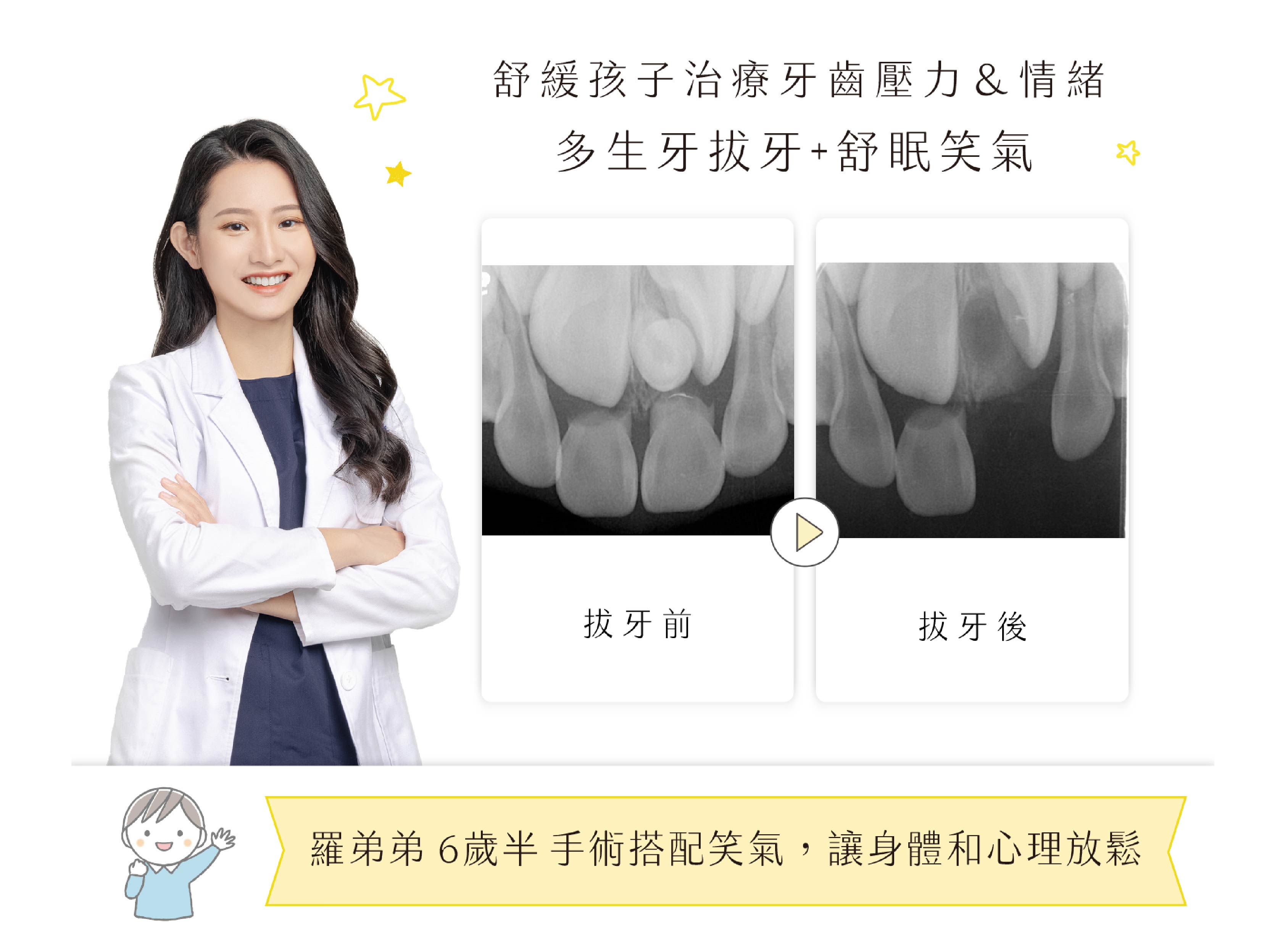舒緩孩子治療牙齒的壓力＆情緒：舒眠笑氣＋多生牙拔牙  潘沐晨醫師 案例分享